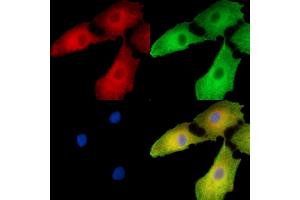 ABIN7096260 and ABIN7100322 staining  cells by IF/ICC.