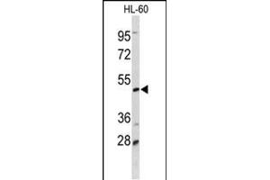 Western blot analysis of DCP2 Antibody (Center) (ABIN653129 and ABIN2842708) in HL-60 cell line lysates (35 μg/lane).