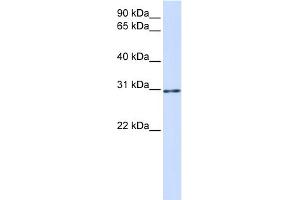 WB Suggested Anti-AKT1S1 Antibody Titration:  0. (PRAS40 antibody  (C-Term))