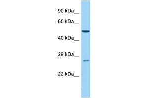 Host:  Rabbit  Target Name:  Cyp4b1  Sample Type:  Mouse Testis lysates  Antibody Dilution:  1. (CYP4B1 antibody  (C-Term))
