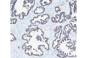 IHC analysis of Cytokeratin 8/KRT8 using anti-Cytokeratin 8/KRT8 antibody (ABIN5518853). (KRT8 antibody  (AA 107-325))
