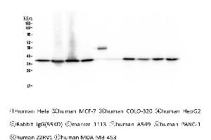 Western blot analysis of APE1 using anti-APE1 antibody .