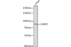 Western blot analysis of extracts of Jurkat cells, using C Rabbit pAb (ABIN7266034) at 1:1000 dilution.