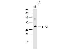 Molt-4 lysates probed with IL-13 Polyclonal Antibody, Unconjugated  at 1:500 dilution and 4˚C overnight incubation. (IL-13 antibody  (AA 45-56))