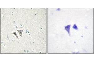 Immunohistochemistry (IHC) image for anti-Activin Receptor Type 1C (ACVR1C) (AA 201-250) antibody (ABIN2889678) (ACVR1C/ALK7 antibody  (AA 201-250))