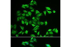 Immunofluorescence analysis of A549 cells using POMGNT2 Polyclonal Antibody (C3orf39 antibody)