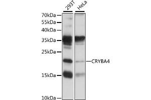 Western blot analysis of extracts of various cell lines, using CRYB antibody (ABIN7266530) at 1:1000 dilution. (CRYbA4 antibody  (AA 1-196))