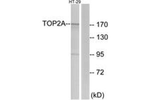 Western blot analysis of extracts from HT-29 cells, using TOP2A Antibody. (Topoisomerase II alpha antibody  (AA 1-50))