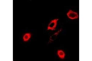 Immunofluorescent analysis of GPx-4 staining in A549 cells. (GPX4 antibody)