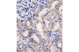 (ABIN655076 and ABIN2844708) staining HTR2B in human kidney tissue sections by Immunohistochemistry (IHC-P - paraformaldehyde-fixed, paraffin-embedded sections). (Serotonin Receptor 2B antibody  (C-Term))