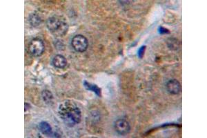 Used in DAB staining on fromalin fixed paraffin-embedded Liver tissue (Caspase 8 antibody  (AA 385-479))