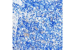 Immunohistochemistry of paraffin-embedded Mouse spleen using HC Rabbit pAb (ABIN7267805) at dilution of 1:100 (40x lens). (GPR109B antibody)