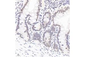 Immunohistochemistry (Paraffin-embedded Sections) (IHC (p)) image for anti-Polyglutamine Binding Protein 1 (PQBP1) antibody (ABIN7075126)