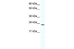 WB Suggested Anti-HOXB7 Antibody Titration:  1. (HOXB7 antibody  (Middle Region))
