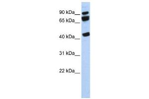 WB Suggested Anti-DDX17  Antibody Titration: 0.