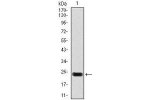 Western blot analysis using troponin T2 mAb against human troponin T2 (AA: 88-249) recombinant protein. (Cardiac Troponin T2 antibody)