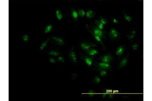 Immunofluorescence of monoclonal antibody to MPHOSPH10 on HeLa cell. (MPHOSPH10 antibody  (AA 348-457))