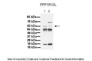 Lanes:   1. (PPP1R13L antibody  (Middle Region))