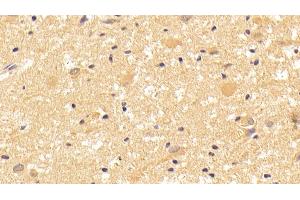Immunohistochemistry (IHC) image for anti-Wingless-Type MMTV Integration Site Family, Member 7B (WNT7B) (AA 216-349) antibody (ABIN7430198)