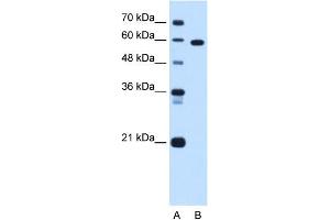 WB Suggested Anti-TBX15 Antibody Titration:  1. (T-Box 15 antibody  (C-Term))