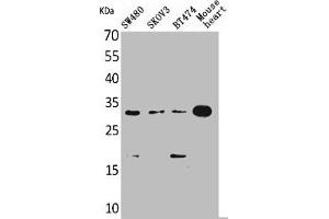 Western Blot analysis of SW480 SKOV3 BT474 mouse heart cells using FGF-18 Polyclonal Antibody (FGF18 antibody  (C-Term))