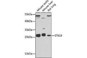 Western blot analysis of extracts of various cell lines, using STK19 antibody (ABIN6132689, ABIN6148598, ABIN6148600 and ABIN6217358) at 1:1000 dilution. (STK19 antibody  (AA 75-364))