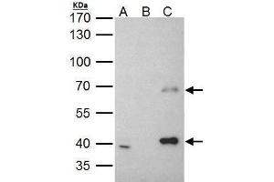 IP Image MSL3L1 antibody immunoprecipitates MSL3L1 protein in IP experiments. (MSL3 antibody  (Center))