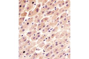 (ABIN6243360 and ABIN6577092) staining FER in human liver tissue sections by Immunohistochemistry (IHC-P - paraformaldehyde-fixed, paraffin-embedded sections). (FER antibody  (AA 1-300))