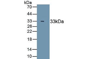 Detection of Recombinant MYH4, Human using Monoclonal Antibody to Myosin Heavy Chain 4, Skeletal Muscle (MYH4) (MYH4 antibody  (AA 1633-1875))