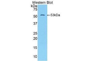 Western Blotting (WB) image for anti-Solute Carrier Family 2 (Facilitated Glucose Transporter), Member 14 (SLC2A14) (AA 51-105) antibody (ABIN1859032) (SLC2A14 antibody  (AA 51-105))