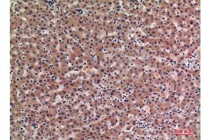 Immunohistochemistry (IHC) analysis of paraffin-embedded Human Liver, antibody was diluted at 1:100. (IGFBPI antibody  (Internal Region))