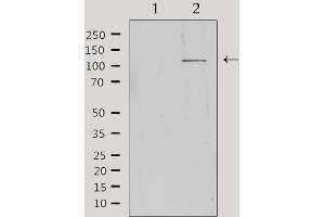 MBTPS1 antibody  (Internal Region)