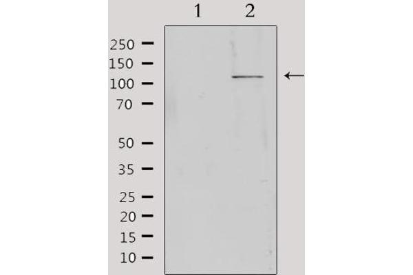 MBTPS1 antibody  (Internal Region)