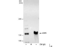 IP Image Immunoprecipitation of USP8 protein from HCT-116 whole cell extracts using 5 μg of USP8 antibody, Western blot analysis was performed using USP8 antibody, EasyBlot anti-Rabbit IgG  was used as a secondary reagent. (USP8 antibody)