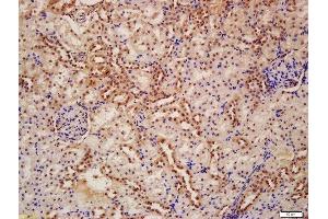 Formalin-fixed and paraffin embedded rat kidney labeled with Anti-APG7 Polyclonal Antibody, Unconjugated  at 1:200 followed by conjugation to the secondary antibody and DAB staining (ATG7 antibody  (AA 21-120))