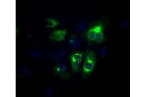 Image no. 2 for anti-Lipase, Endothelial (LIPG) antibody (ABIN1499165) (LIPG antibody)