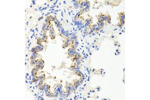 Immunohistochemistry of paraffin-embedded rat lung using SHH antibody at dilution of 1:100 (x40 lens). (Sonic Hedgehog antibody)