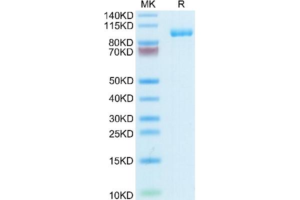 Thyroperoxidase Protein (AA 19-846) (His tag)