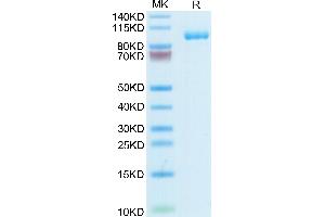 Human TPO/Thyroid Peroxidase on Tris-Bis PAGE under reduced condition. (Thyroperoxidase Protein (AA 19-846) (His tag))