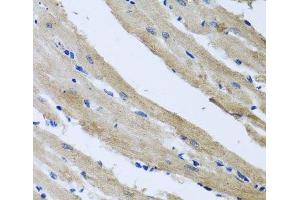 Immunohistochemistry of paraffin-embedded Rat heart using ST8SIA2 Polyclonal Antibody at dilution of 1:100 (40x lens).