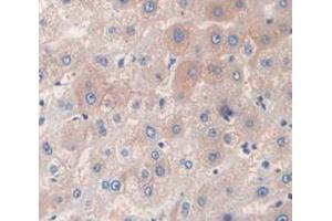 Immunohistochemistry (IHC) image for anti-Interleukin 6 Signal Transducer (Gp130, Oncostatin M Receptor) (IL6ST) (AA 606-756) antibody (ABIN1859040)