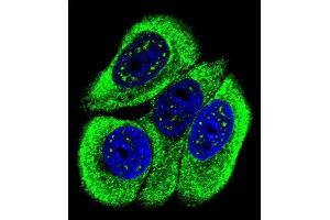 Confocal immunofluorescent analysis of Phospho-ABL1- Antibody (ABIN6241067 and ABIN6578924) with MCF-7 cell followed by Alexa Fluor 488-conjugated goat anti-rabbit lgG (green). (ABL1 antibody  (pTyr251))