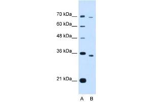 PHF6 antibody (20R-1278) used at 0.