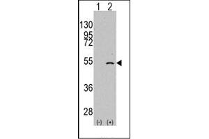 Image no. 1 for anti-Elongator complex protein 3 (ELP3) (C-Term) antibody (ABIN356662) (ELP3/KAT9 antibody  (C-Term))