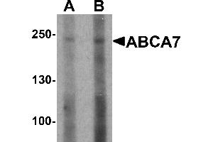 Western blot analysis of ABCA7 in 293 cell lysate with ABCA7 antibody at (A) 1 and (B) 2 µg/mL. (ABCA7 antibody  (N-Term))