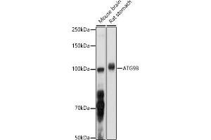 Western blot analysis of extracts of various cell lines, using B antibody (ABIN6133279, ABIN6137271, ABIN6137272 and ABIN6223276) at 1:1000 dilution. (ATG9B antibody  (AA 715-924))