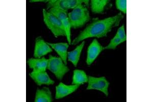 Immunofluorescence of human HeLa cells stained with Hoechst 33342 (Blue) and monoclonal anti-Hexokinase antibody (1:1000) with Alexa 488 (Green). (Hexokinase 1 antibody)