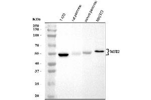 Western blot analysis of TROP2/TACSTD2 using anti-TROP2/TACSTD2 antibody (ABIN7603102).