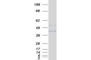 Validation with Western Blot
