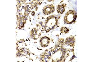 Immunohistochemistry of paraffin-embedded human breast using RPL13 Antibody (ABIN5974062) at dilution of 1/100 (40x lens). (RPL13 antibody)
